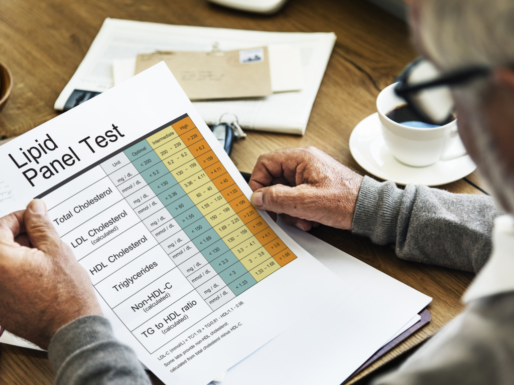 What Does Cholesterol Tell You and How Often Should You Get Tested?