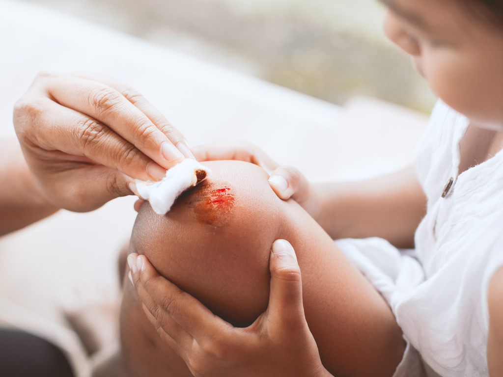 How to Treat Minor Cuts or Scrapes